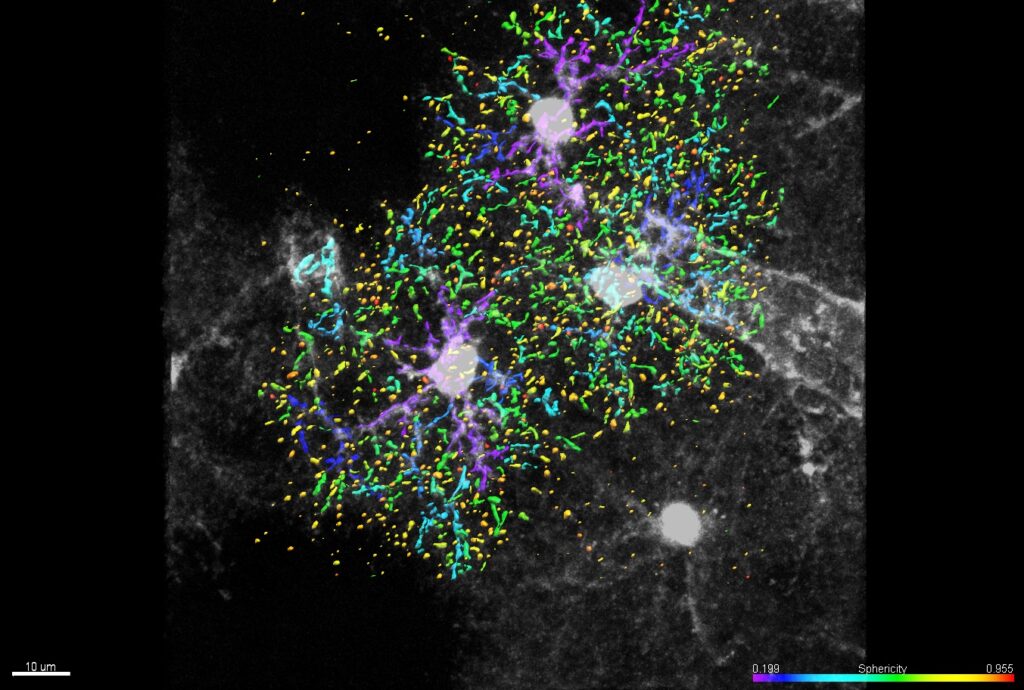 astrociti cellule stellate sviluppo cervello