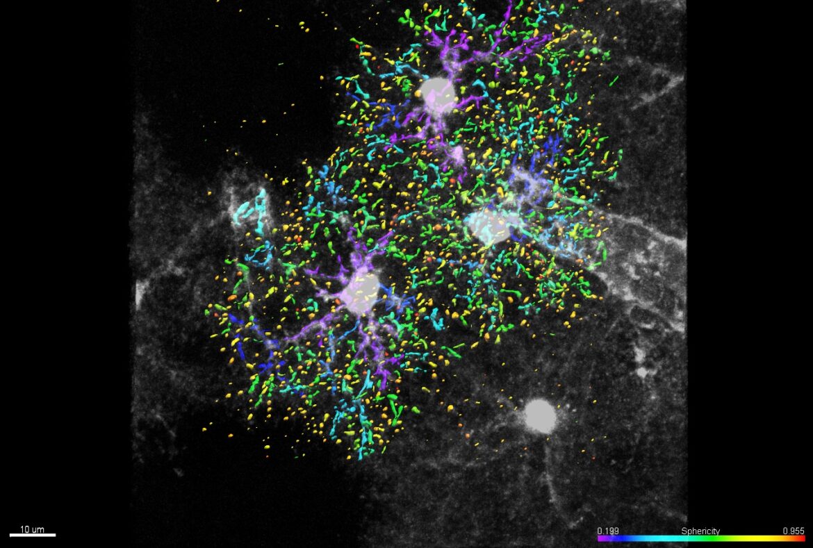 astrociti cellule stellate sviluppo cervello