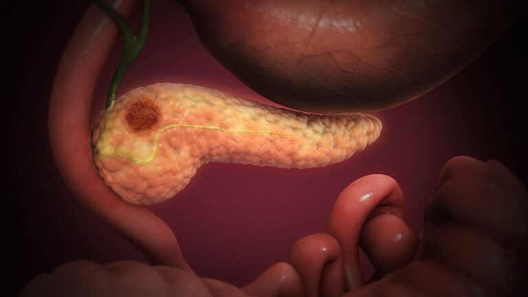 farmacologico tumore pancreatico