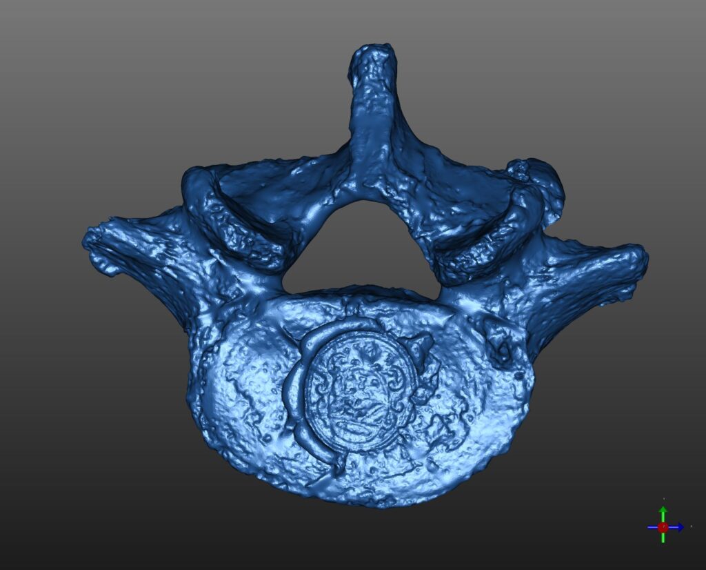 vertebra di Galileo Galilei