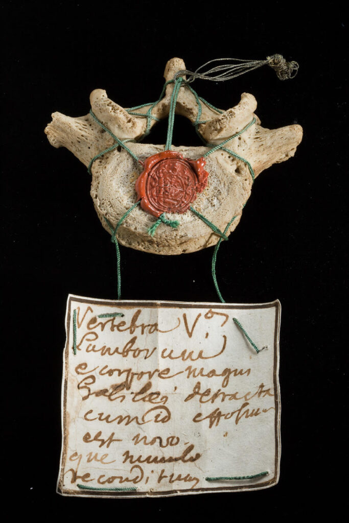 La vertebra di Galileo Galilei
