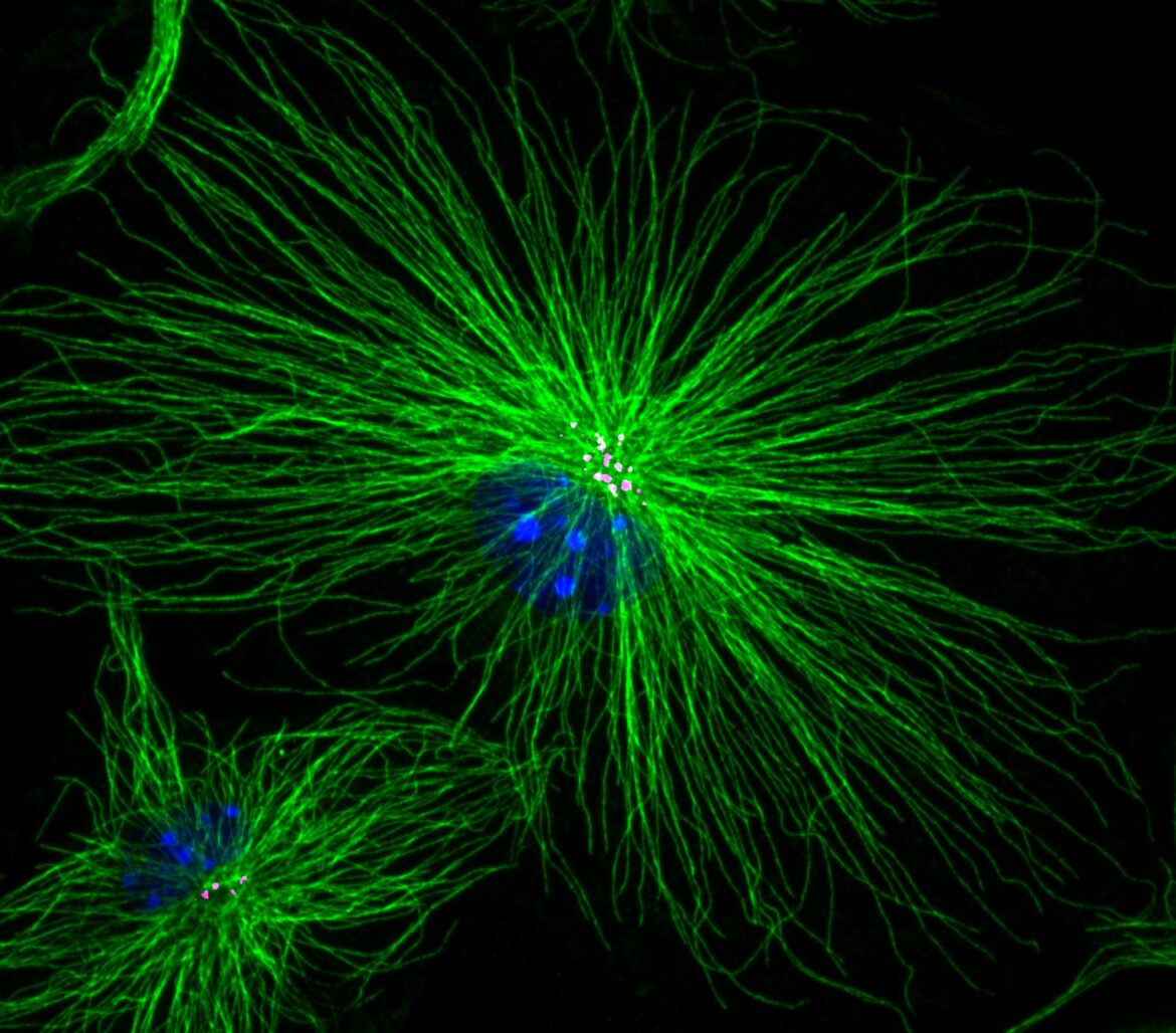 sistema immunitario cerebrale microglia