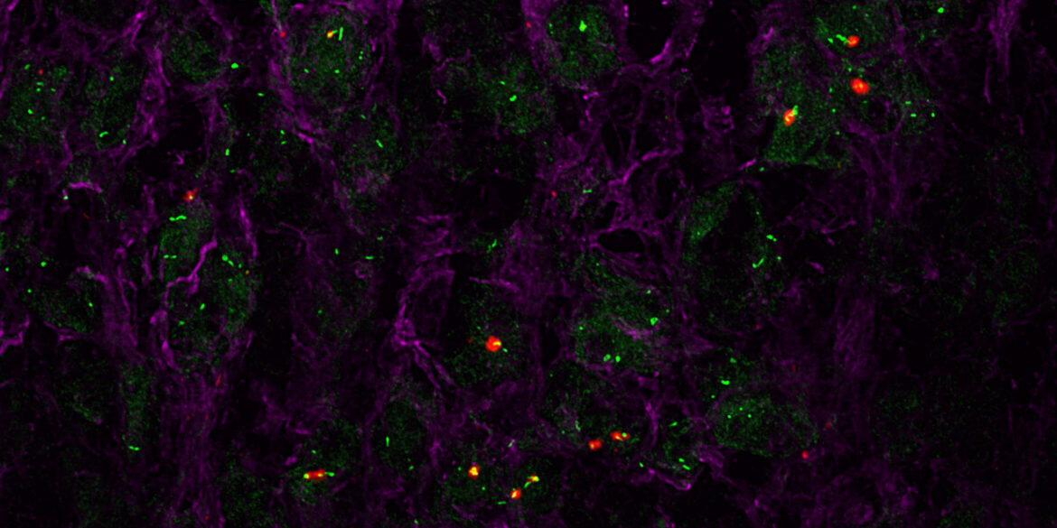 Charme: la molecola di lncRNA che controlla lo sviluppo del cuore 