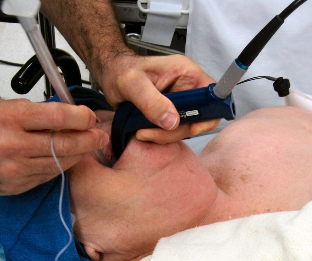 videolaringoscopio intubazione tracheale paziente critico