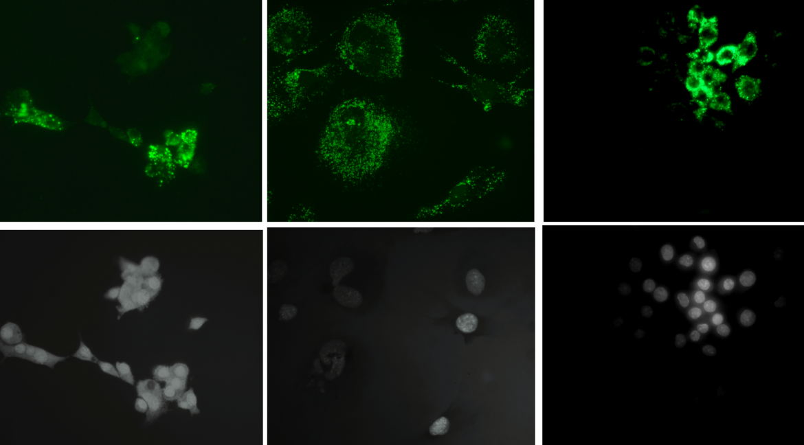 Nel pannello ordinato (pannelo A) compaiono, partendo da sinistra: osteociti, osteoblasti e osteoclasti (fila superiore localizzazione delle nanoplastiche, fila inferiore visibili i nuclei e i contorni delle cellule. Crediti per l'immagine: Lavinia Casati