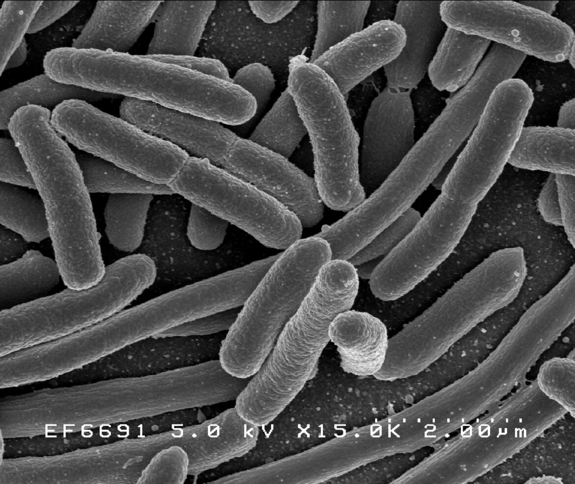 Escherichia coli enzima colon-retto
