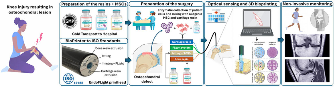 EndoFLight: la chirurgia del futuro ripara le articolazioni con biomateriali e stampanti 3D EndoFlight una infografica sulla tecnologia che verrà sviluppata