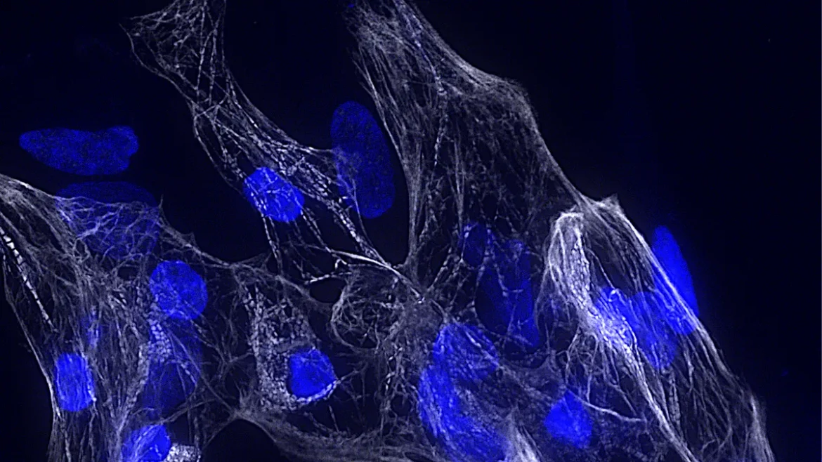 HSCHARME: scoperto un nuovo gene chiave per la salute del cuore, che apre nuove prospettive nella diagnosi e nella terapia delle cardiomiopatie Immagine rappresentativa di cardiomiociti umani derivati da cellule staminali pluripotenti