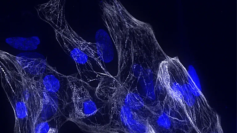 HSCHARME: scoperto un nuovo gene chiave per la salute del cuore, che apre nuove prospettive nella diagnosi e nella terapia delle cardiomiopatie Immagine rappresentativa di cardiomiociti umani derivati da cellule staminali pluripotenti